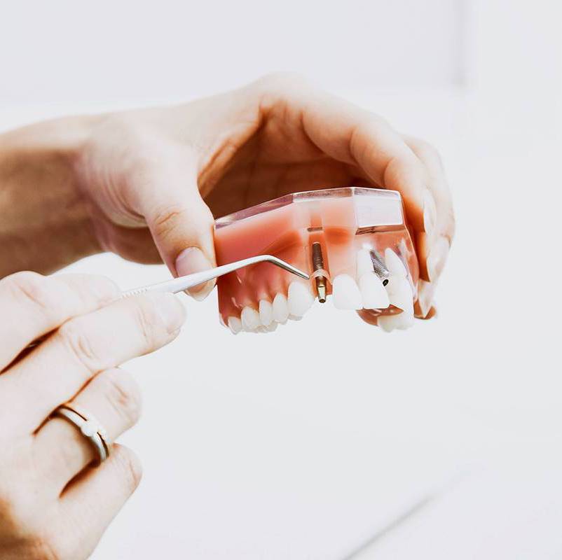 dentista genova tiraoro igiene orale cosmetica sbiancamento