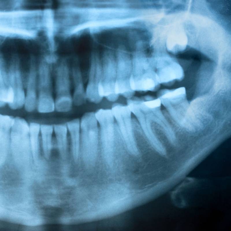 dentista genova tiraoro igiene orale cosmetica sbiancamento