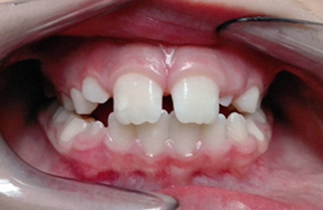 dentista genova tiraoro logopedista