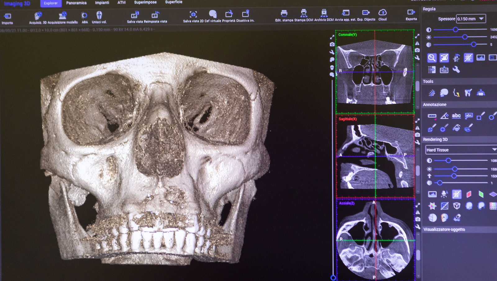 radiografia-maxillo-facciale